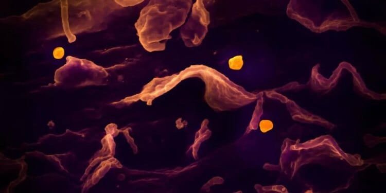Rare, deadly Nipah virus in Kerala: What are the symptoms?