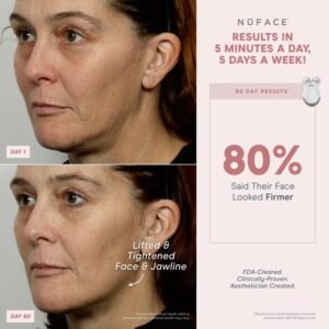 NuFACE MINI Classic Microcurrent Facial Device Kit - Face Sculpting Tool & Neck Tightening Device to Contour, Lift, Smooth & Tone + Activating Aqua Conductive Gel for Microcurrent Treatment - Image 3