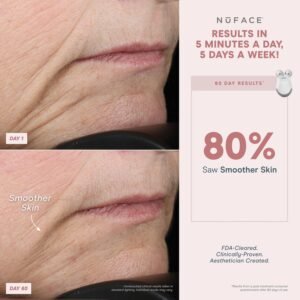 NuFACE MINI Classic Microcurrent Facial Device Kit - Face Sculpting Tool & Neck Tightening Device to Contour, Lift, Smooth & Tone + Activating Aqua Conductive Gel for Microcurrent Treatment - Image 6