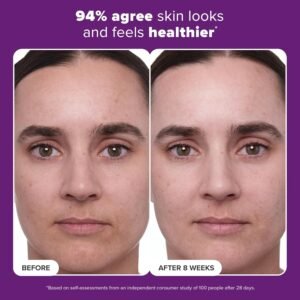 Paula's Choice CLINICAL 1% Retinol Treatment Cream with Peptides, Vitamin C & Licorice Extract, Anti-Aging & Wrinkles - Image 6