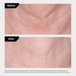 Revision Skincare Nectifirm® Advanced, Anti Aging Neck Firming Cream with Peptides for Fine Lines, Wrinkles and Crepey Skin - Image 7