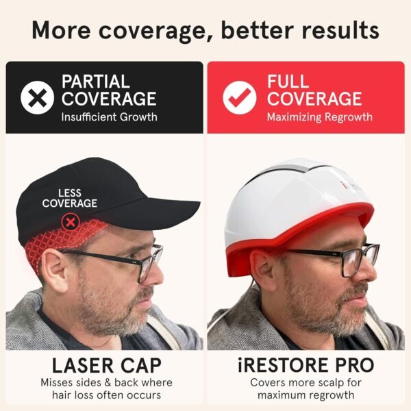 🌿 iRestore Professional Laser Red Light Therapy for Hair Growth System - FDA Cleared Hair Loss, Hair Thinning & Alopecia Treatment for Men & Women - 282 Lasers & LEDs – Immunity, Bone & Wellness Support - Image 3