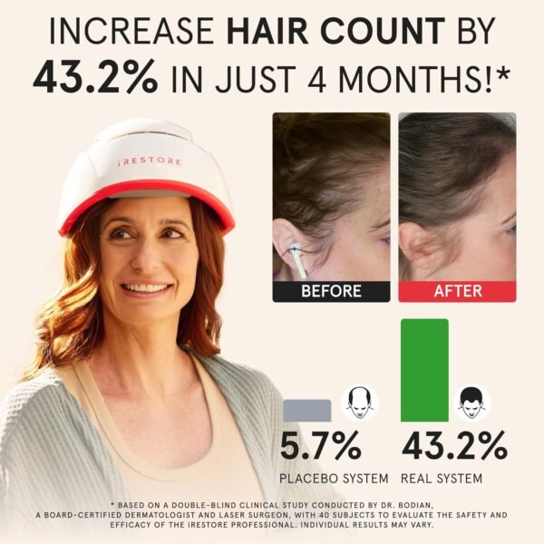 🌿 iRestore Professional Laser Red Light Therapy for Hair Growth System - FDA Cleared Hair Loss, Hair Thinning & Alopecia Treatment for Men & Women - 282 Lasers & LEDs – Immunity, Bone & Wellness Support - Image 4