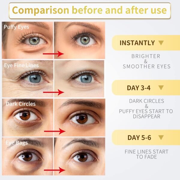 24K Gold Under Eye Patches - 60 Pack for Puffy Eyes, Dark Circles, Bags & Wrinkles with Collagen & Hyaluronic Acid - Image 3