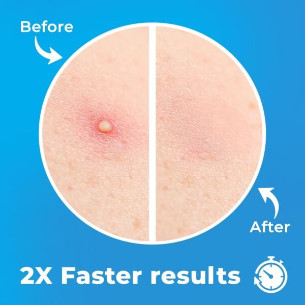 Pimple Patches for Face (120 Patches), Hydrocolloid Acne Patches with Tea Tree Oil, Pimple Patch Pimple Stickers - Hydrocolloid Patch Acne Dots - Acne Pimple Patches For Face - Zit Patches - Image 3