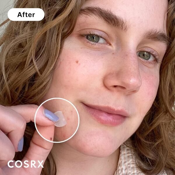 COSRX Acne Pimple Patch Absorbing Hydrocolloid Original 3 Size Patches for Zits Cover, Spot Stickers for Face and Body, Not Tested on Animals, No Toxic Ingredients (120 Count (Pack of 5)) - Image 2